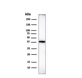 Histone H1 Antibody for WB. Western blot analysis of nucleosome spacing-associated histone H1 expression in human heart tissue lysate. A band is detected at approximately 22-33 kDa, consistent with the predicted molecular weight range of Histone H1 family proteins, with lower bands corresponding to unmodified forms and higher bands reflecting post-translationally modified variants. The observed band pattern aligns with the role of histone H1 in linker DNA organization and regulation of nucleosome spacing within chromatin.