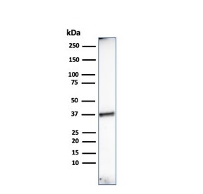 Histone H1 Antibody for WB. Western blot analysis of histone H1 expression in human heart tissue lysate. A band is detected at approximately 27-33 kDa, compared to the predicted molecular weight of Histone H1 family proteins at approximately 20 kDa. The higher apparent molecular weight is consistent with post-translational modifications such as phosphorylation, which are known to alter electrophoretic mobility of linker histone H1.