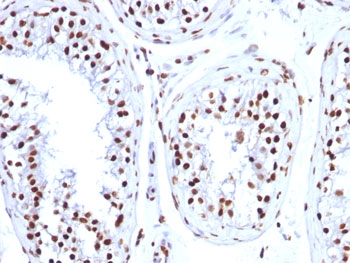 IHC: FFPE human testicular carcinoma tested with Histone H1 antibody (clone HH1/957).