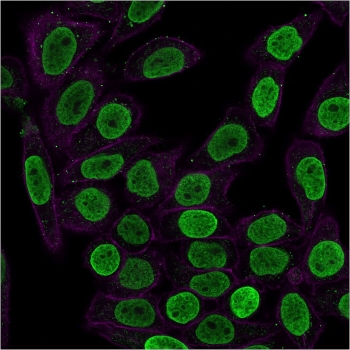 Histone H1 Antibody for IF. Immunofluorescence analysis of histone H1 variant family expression in permeabilized human HeLa cells using Histone H1 Antibody (green). Strong nuclear staining is observed, consistent with localization of linker histone H1 isoforms within chromatin and reflecting variant-associated chromatin organization across the nucleus. Clone HH1/957 antibody demonstrates uniform nuclear enrichment with minimal cytoplasmic signal. Actin filaments are labeled with phalloidin (red), providing cytoskeletal contrast to the chromatin-associated histone signal.
