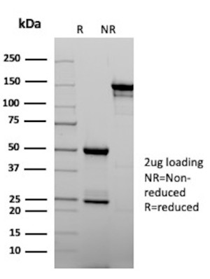 Purified HLA-DQ Antibody SPM422 SDS-PAGE. Electrophoretic analysis of purified HLA-DQ Antibody SPM422 / HLA Class II DQ Antibody under reducing (R) and non-reducing (NR) conditions using a 2 ug antibody load. The non-reduced antibody migrates predominantly near ~140-150 kDa, while reduction produces prominent immunoglobulin heavy and light chain components near ~50 kDa and ~25 kDa, respectively, supporting the integrity and purity of the antibody preparation.
