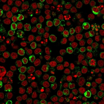 HLA-DR Antibody Clone LN3 immunofluorescence staining of human Ramos cells. Immunofluorescence analysis was performed using HLA-DR Antibody Clone LN3 to detect Human leukocyte antigen DR alpha / HLA-DRA (green), a major histocompatibility complex class II antigen expressed on B lymphocytes. Nuclei were counterstained with Reddot nuclear stain (red). The staining pattern shows strong membrane-associated signal consistent with HLA-DR expression on Ramos B lymphoma cells, a model cell line commonly used to study antigen-presenting immune cells.