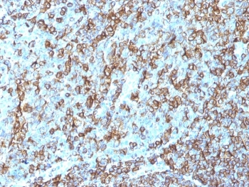 HLA-DR Antibody Clone LN3 immunohistochemistry staining of human tonsil tissue. IHC analysis of FFPE human tonsil was performed using HLA-DR Antibody Clone LN3 following heat induced epitope retrieval by boiling tissue sections in pH 9 10mM Tris with 1mM EDTA for 20 min and allowing sections to cool before testing. HRP-DAB brown staining highlights HLA-DR positive immune cells within the tonsillar lymphoid tissue, consistent with expression of Human leukocyte antigen DR alpha / HLA-DRA on antigen-presenting cells including B lymphocytes and other immune cells within germinal center regions.