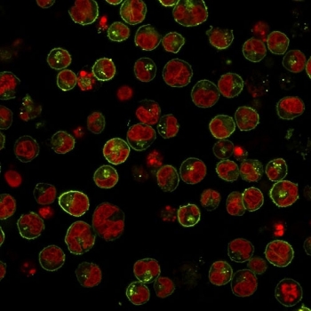 HLA-DRB1 Antibody for IF SPM289 immunofluorescence analysis of human cells. Immunofluorescent staining of human Raji cells using HLA-DRB1 Antibody for IF clone SPM289 reveals strong membranous and peripheral cell surface fluorescence consistent with expression of the HLA-DR beta chain / HLA-DRB1 on antigen-presenting B lymphocytes. Cells were labeled with the mouse monoclonal antibody followed by a fluorescent secondary antibody producing green signal, while nuclei are counterstained with Reddot (red). The staining pattern highlights the characteristic plasma membrane localization of MHC class II HLA-DR molecules involved in peptide antigen presentation.