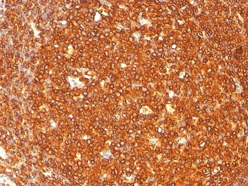 IHC staining of FFPE human tonsil with HLA-DRB1 antibody SPM289. HIER: boil tissue sections in pH 9 10mM Tris with 1mM EDTA for 10-20 min and allow to cool before testing.
