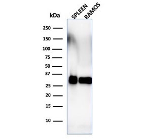 Western blot testing of human spleen and Ramos lysate with HLA-DRB1 antibody (clone SPM288). Predicted molecular weight ~30 kDa.