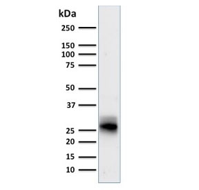 Western blot testing of human spleen lysate with HLA-DRB1 antibody (clone SPM423). Predicted molecular weight ~30 kDa.