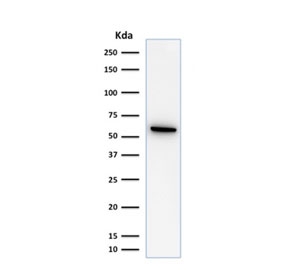Western blot testing of human HeLa lysate with HSP60 antibody (clone SPM253). Predicted molecular weight: ~60 kDa.