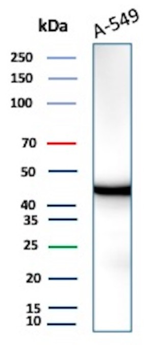IDH1 Antibody IDH1/1152 Detects Endogenous IDH1 in A-549 Lung Cancer Cells WB. Western blot analysis of human A-549 lung carcinoma cell lysate using IDH1 Antibody, clone IDH1/1152. A strong, discrete band is detected at approximately 45-47 kDa, consistent with the expected molecular weight of cytosolic isocitrate dehydrogenase 1. The low background and absence of prominent additional bands demonstrate clean recognition of endogenous IDH1 in this human lung cancer cell line.