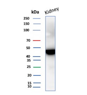 IDH1 Antibody IDH1/1152 Detects Endogenous IDH1 in Human Kidney WB. Western blot analysis of human kidney tissue lysate using IDH1 Antibody, clone IDH1/1152. A strong, discrete band is detected at approximately 45-47 kDa, consistent with the expected molecular weight of cytosolic isocitrate dehydrogenase 1. The prominent target band and limited additional reactivity demonstrate clean detection of endogenous IDH1 in human kidney tissue.