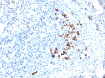 IgA Antibody Clone HISA43 in human tonsil by immunohistochemistry. Formalin-fixed paraffin-embedded human tonsil tissue stained with IgA Antibody Clone HISA43 shows HRP-DAB brown cytoplasmic staining in scattered plasma cells within the tonsillar lymphoid tissue, consistent with expression of Immunoglobulin alpha heavy chain (IGHA), the heavy chain component of IgA antibodies produced by differentiated B cells. Positive cells are primarily located in interfollicular regions and surrounding lymphoid follicles, while most surrounding lymphocytes remain negative. Heat induced epitope retrieval was performed by boiling tissue sections in pH 9 Tris-EDTA buffer (10mM Tris, 1mM EDTA) for 10-20 minutes followed by cooling prior to antibody incubation.