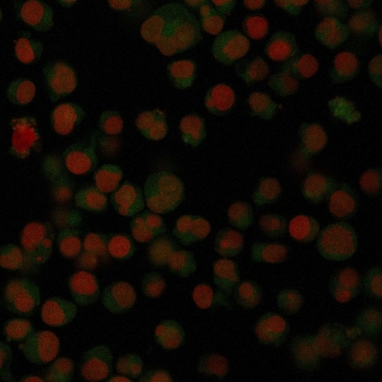 Immunofluorescence IgA Antibody CF488 Conjugate Clone IA761 in human Raji cells. Immunofluorescent analysis of PFA-fixed human Raji cells stained with IgA Antibody CF488 Conjugate Clone IA761. The mouse monoclonal antibody directly labeled with CF488 produces green fluorescence highlighting IgA-positive signal within the cell population, while nuclei are counterstained with Reddot nuclear dye (red). The fluorescence pattern demonstrates detection of Immunoglobulin alpha heavy chain (IGHA), the heavy chain component of IgA antibodies, allowing visualization of IgA-associated signal in cultured human B cell-derived Raji cells.