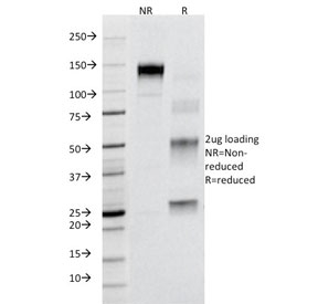 SDS-PAGE Analysis of Purified, BSA-Free Fas Antibody B-R18. Confirmation of Integrity and Purity of the Antibody.