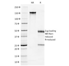 SDS-PAGE analysis of purified, BSA-free Cytokeratin 7 antibody (clone OV-TL12/30) as confirmation of integrity and purity.
