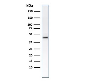 Western blot testing of human HCT-116 cell lysate with Cytokeratin 8 antibody (clone B22.1).