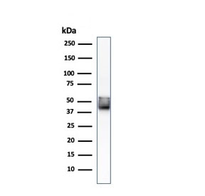 Keratin 8 Antibody HCT-116 Western Blot. Western blot analysis of human HCT-116 cell lysate using Keratin 8 Antibody (clone KRT8/803) demonstrates a prominent band at approximately 52 kDa, consistent with the expected molecular weight of Cytokeratin 8 (KRT8). Cytokeratin 8 is a type II intermediate filament protein widely expressed in simple epithelial cells and epithelial-derived tumors, where it contributes to cytoskeletal organization, cellular integrity, and stress-response signaling pathways. Detection of the expected molecular weight band supports expression of Cytokeratin 8 in HCT-116 cells and the suitability of clone KRT8/803 for western blot applications.