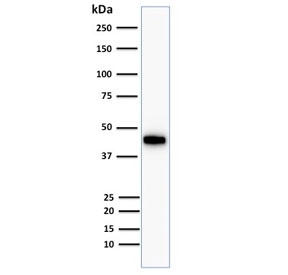 Western blot testing of human HCT116 cells with Cytokeratin 18 antibody cocktail. Predicted molecular weight ~45 kDa.
