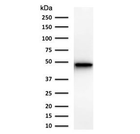 Western blot testing of human PC3 cell lysate using KRT19 antibody (clone Ks19.1). Predicted molecular weight ~43 kDa.