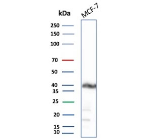 Western blot testing of human MCF7 cell lysate with EpCAM antibody. Expected molecular weight: ~35 kDa (unmodified), 40-43 kDa (glycosylated).
