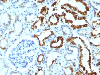 IHC analysis of FFPE human renal cell carcinoma tested with MFGE8 antibody (clone MFG-06).