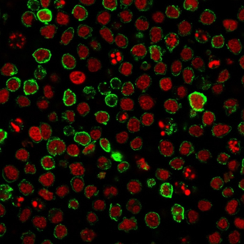 Immunofluorescence analysis of Neprilysin/CD10 antibody (clone FR4D11) in human Ramos cells. Cells were stained with Neprilysin/CD10 antibody followed by goat anti-Mouse IgG conjugated to CF488 (green). Distinct membranous staining is observed outlining the cell surface, consistent with CD10 localization. Nuclei are counterstained with Reddot (red).