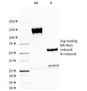 SDS-PAGE Analysis of Purified, BSA-Free MUC1 Antibody (clone MUC1/520). Confirmation of Integrity and Purity of the Antibody.