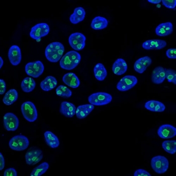 Nucleolin Antibody immunofluorescence analysis of human HeLa cells. Permeabilized human HeLa cells stained with AF488-labeled Nucleolin Antibody for Flow Cytometry (clone NCL/902). Green fluorescence highlights nucleolin-positive nucleoli within the nuclei, consistent with the expected nuclear and nucleolar localization of Nucleolin / NCL, while DAPI (blue) stains cell nuclei.