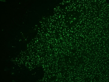 Nucleolin Antibody CF488 Conjugate for IF immunofluorescence analysis of human colon carcinoma tissue. Immunofluorescent staining of human colon carcinoma with Nucleolin Antibody CF488 Conjugate (clone NCL/902). Direct CF488 labeling produces bright green fluorescence highlighting nuclei and nucleolar compartments consistent with the expected nuclear localization of Nucleolin / NCL in tumor cells.