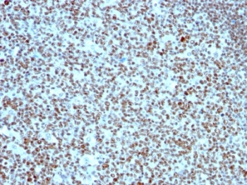 NCL Antibody immunohistochemistry analysis of human tonsil. Formalin-fixed paraffin-embedded human tonsil stained with NCL Antibody (clone 364-5). HRP-DAB brown chromogenic staining highlights nuclei of lymphoid cells within tonsillar tissue, consistent with the nuclear and nucleolar localization of Nucleolin / NCL. Staining of formalin-fixed tissues is enhanced by boiling tissue sections in 10mM citrate buffer, pH 6.0, for 10-20 minutes followed by cooling at RT for 20 minutes.