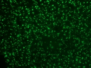 NCL Antibody for IF - Immunofluorescence analysis of human colon carcinoma tissue. Formalin-fixed paraffin-embedded human colon carcinoma stained with AF488 conjugate of NCL Antibody for IF (clone 364-5). The mouse monoclonal antibody highlights nucleolin-positive nuclei and nucleolar compartments consistent with the expected nuclear localization of Nucleolin / NCL. Green fluorescence marks NCL-positive tumor cell nuclei. Antigen retrieval was performed by boiling tissue sections in 10mM citrate buffer, pH 6.0, for 10-20 minutes followed by cooling at RT for 20 minutes prior to staining.