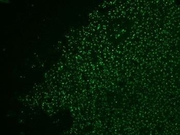 IHC: Formalin-fixed, paraffin-embedded human colon carcinoma stained with AF488 Conjugate of Nucleolin antibody.