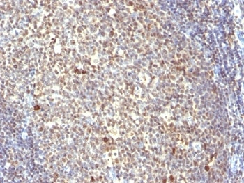 NuMA Antibody Tonsil IHC. Immunohistochemistry analysis of formalin-fixed, paraffin-embedded human tonsil stained with NuMA antibody (clone SPM300).