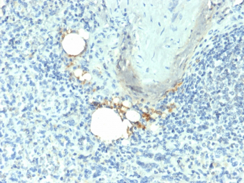 TRAcP Antibody Spleen IHC Macrophage Staining. Immunohistochemistry analysis of Tartrate-resistant acid phosphatase / ACP5 in FFPE human spleen tissue using TRAcP Antibody for IHC. HRP-DAB brown chromogenic staining highlights scattered macrophage-lineage cells within splenic tissue, with cytoplasmic localization consistent with lysosomal enzyme expression, while surrounding lymphoid cells remain largely negative. The staining pattern supports detection of ACP5-positive histiocytic populations within spleen architecture.