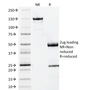 SDS-PAGE Analysis of Purified, BSA-Free Beta-2 Microglobulin Antibody (clone BBM.1). Confirmation of Integrity and Purity of the Antibody.