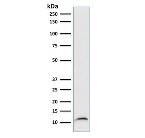 Western blot testing of human Raji cell lysate with Beta-2-Microglobulin antibody (clone B2M/961).