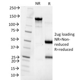 SDS-PAGE Analysis of Purified, BSA-Free Parathyroid Hormone Antibody Clone 3H9. Confirmation of Integrity and Purity of the Antibody.