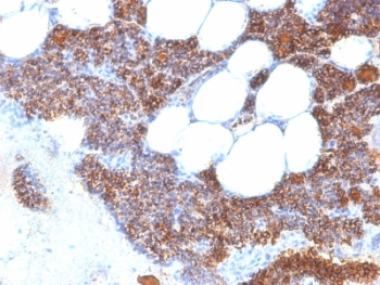 Parathyroid Hormone Antibody N Terminus immunohistochemistry of human parathyroid gland. FFPE human parathyroid tissue stained with Parathyroid Hormone Antibody N Terminus clone SPM604, a mouse monoclonal antibody recognizing the N-terminal region of Parathyroid hormone (PTH). Strong cytoplasmic brown chromogenic staining is observed in parathyroid endocrine chief cells, consistent with the known intracellular localization of Parathyroid hormone in hormone-producing cells of the parathyroid gland.