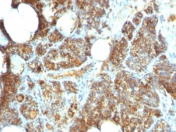 PTH Antibody C Terminus immunohistochemistry of human parathyroid gland. FFPE human parathyroid tissue stained with PTH Antibody C Terminus / Parathyroid Hormone Antibody clone PTH/1173, a mouse monoclonal antibody recognizing the C-terminal region of Parathyroid hormone (PTH). Strong cytoplasmic brown chromogenic staining is observed in parathyroid endocrine chief cells, consistent with the expected intracellular localization of Parathyroid hormone within hormone-producing cells of the parathyroid gland.