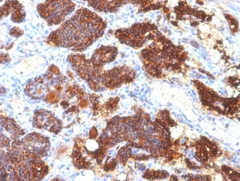 PTH Antibody for IHC immunohistochemistry analysis of Parathyroid hormone in human parathyroid tissue. FFPE human parathyroid tissue was stained using PTH antibody clone PTH/1175 following heat induced epitope retrieval prior to staining. HRP-DAB brown chromogenic signal highlights strong cytoplasmic staining in parathyroid endocrine cells, consistent with the known expression of Parathyroid hormone (PTH) in hormone-producing chief cells that regulate systemic calcium homeostasis. The staining pattern demonstrates robust detection of parathyroid endocrine tissue and supports the use of PTH Antibody for IHC / Parathyroid Hormone Antibody (clone PTH/1175) for immunohistochemistry analysis of PTH expression in human tissue sections.