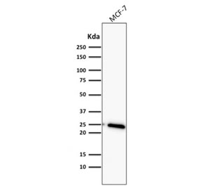 Western blot testing of human MCF7 cell lysate with Bcl2 antibody (clone BCL2/782). Routinely observed at 18-22 kDa.