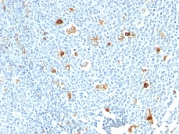 IHC staining of formalin-fixed, paraffin-embedded human tonsil tissue with Calprotectin antibody (CPT/1028). Staining of formalin-fixed tissues requires boiling tissue sections in 10mM Citrate buffer, pH 6.0, for 10-20 min followed by cooling at RT for 20 min.