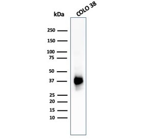 Western blot testing of human COLO-38 cell lysate with PMEL17 antibody (clone PMEL/783). The ~100 kDa glycosylated PMEL precursor is proteolytically cleaved into an ~60-64 kDa M-alpha fragment and an ~26 kDa M-beta fragment. The M-alpha fragment is subsequently processed into ~34-38 kDa and ~26 kDa fragments that assemble into the fibrillar matrix of melanosomes.