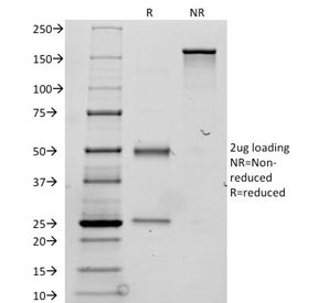 SDS-PAGE Analysis of Purified, BSA-Free Thyroglobulin Antibody / TG Thyroid Hormone Precursor Protein Antibody (clone TGB24). Confirmation of Integrity and Purity of the Antibody.