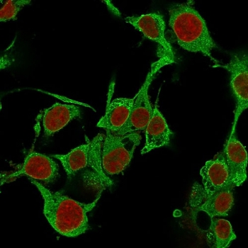 Immunofluorescent staining of PFA-fixed human HepG2 cells with TNF-alpha antibody (green, clone TNFA/1172) and Reddot nuclear stain (red).