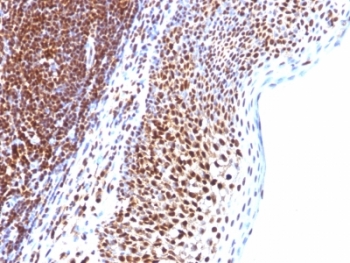 IHC: Formalin-fixed, paraffin-embedded human tonsil stained with SUMO-1 antibody (SUMO1/1188)