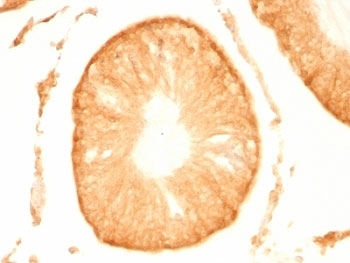 PGP9.5 Antibody / Ubiquitin Hydrolase Pathway Antibody. Immunohistochemistry analysis of PGP9.5 / UCHL1 in FFPE rat testis. IHC staining of formalin-fixed, paraffin-embedded rat testis using PGP9.5 Antibody / Ubiquitin Hydrolase Pathway Antibody shows strong HRP-DAB brown cytoplasmic staining within testicular cells, consistent with intracellular localization of the deubiquitinating enzyme UCHL1. The staining pattern highlights cellular regions associated with active protein turnover and ubiquitin pathway activity, with signal confined to cytoplasmic compartments and minimal background in surrounding structures. Clone UCHL1/775 supports visualization of ubiquitin pathway-associated protein distribution in tissue context.