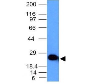 Western blot testing of human brain lysate with UchL1 antibody (clone UCHL1/841). Predicted molecular weight ~25 kDa.