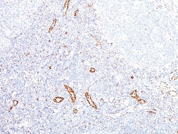 VEGF Antibody Human Tonsil IHC. Immunohistochemical staining of FFPE human tonsil tissue using VEGF Antibody (clone VEGF/1063). An HRP-conjugated secondary antibody with DAB substrate was used for detection. VEGF Antibody / VEGFA demonstrates VEGF expression in vascular structures and stromal-associated cells, consistent with the role of VEGFA in endothelial cell signaling, angiogenesis regulation, vascular remodeling, and tissue homeostasis.