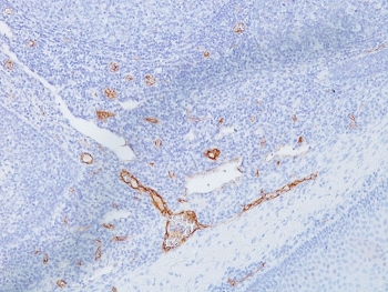 vWF Antibody Clone IIIE2.34 immunohistochemistry analysis. IHC staining of FFPE human tonsil using vWF Antibody Clone IIIE2.34 demonstrates HRP-DAB brown staining in vascular endothelial cells, highlighting vessel structures within lymphoid tissue. The staining is localized to vessel linings with minimal background in surrounding lymphocytes, consistent with the known endothelial expression of von Willebrand factor (VWF). Heat-induced epitope retrieval was performed using pH 9 Tris-EDTA buffer, supporting clear visualization of vascular endothelium.