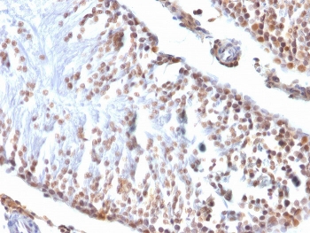 IHC testing of FFPE rat testis with Wilms Tumor 1 antibody (clone 6F-H2). Required HIER: boil tissue sections in pH 9 10mM Tris with 1mM EDTA for 10-20 min followed by cooling at RT for 20 min.